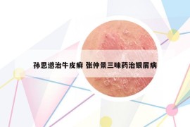 孙思邈治牛皮癣 张仲景三味药治银屑病