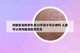 丙酸氯倍他索乳膏10岁孩子可以用吗 儿童可以用丙酸倍他索乳膏