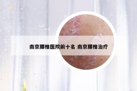 南京腰椎医院前十名 南京腰椎治疗
