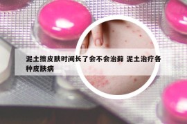 泥土擦皮肤时间长了会不会治藓 泥土治疗各种皮肤病