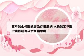 苯甲酸水杨酸软膏治疗银屑病 水杨酸苯甲酸松油搽剂可以治灰指甲吗
