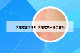 天疱疮能干活吗 天疱疮病人能工作吗