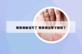 银屑病被诅咒了 银屑病这辈子就毁了