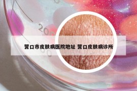 营口市皮肤病医院地址 营口皮肤病诊所