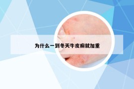 为什么一到冬天牛皮癣就加重