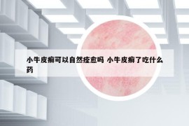 小牛皮癣可以自然痊愈吗 小牛皮癣了吃什么药