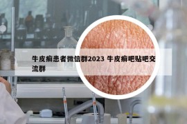 牛皮癣患者微信群2023 牛皮癣吧贴吧交流群