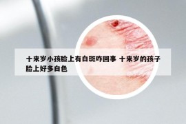 十来岁小孩脸上有白斑咋回事 十来岁的孩子脸上好多白色