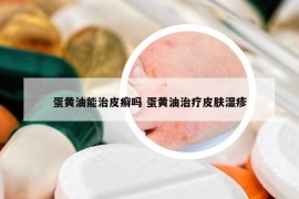 蛋黄油能治皮癣吗 蛋黄油治疗皮肤湿疹