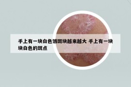 手上有一块白色饿斑块越来越大 手上有一块块白色的斑点