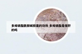 多烯磷脂酰胆碱胶囊的功效 多烯磷脂是保肝的吗