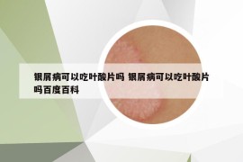 银屑病可以吃叶酸片吗 银屑病可以吃叶酸片吗百度百科