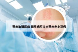 薏米治银屑病 银屑病可以吃薏米赤小豆吗