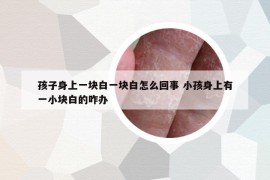 孩子身上一块白一块白怎么回事 小孩身上有一小块白的咋办