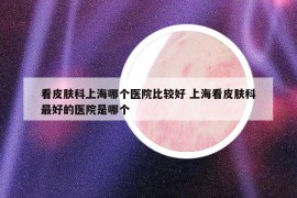 看皮肤科上海哪个医院比较好 上海看皮肤科最好的医院是哪个