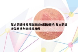 复方酮康唑发用洗剂能长期使用吗 复方酮康唑发用洗剂能经常用吗