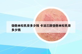 倍他米松乳膏多少钱 卡泊三醇倍他米松乳膏多少钱