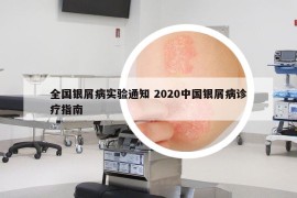 全国银屑病实验通知 2020中国银屑病诊疗指南