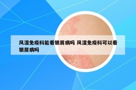 风湿免疫科能看银屑病吗 风湿免疫科可以看银屑病吗