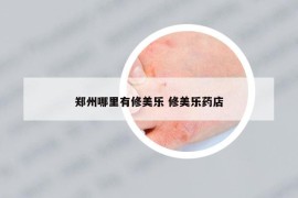 郑州哪里有修美乐 修美乐药店