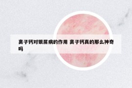 离子钙对银屑病的作用 离子钙真的那么神奇吗