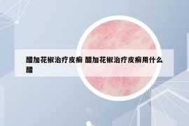 醋加花椒治疗皮癣 醋加花椒治疗皮癣用什么醋