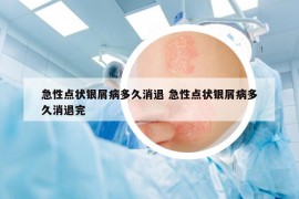 急性点状银屑病多久消退 急性点状银屑病多久消退完
