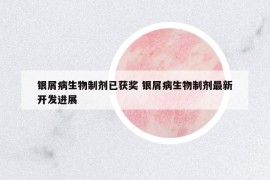 银屑病生物制剂已获奖 银屑病生物制剂最新开发进展
