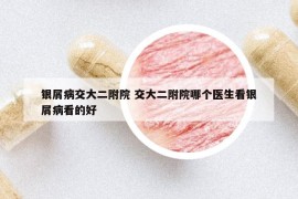 银屑病交大二附院 交大二附院哪个医生看银屑病看的好