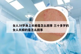 女人39岁身上长癣是怎么回事 三十多岁的女人长癣的是怎么回事