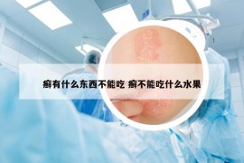 癣有什么东西不能吃 癣不能吃什么水果