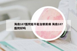 海南187医院能不能治银屑病 海南187医院好吗