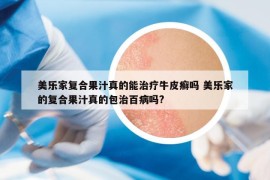 美乐家复合果汁真的能治疗牛皮癣吗 美乐家的复合果汁真的包治百病吗?