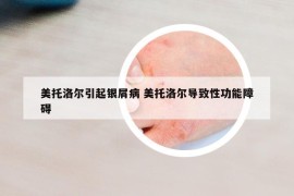 美托洛尔引起银屑病 美托洛尔导致性功能障碍