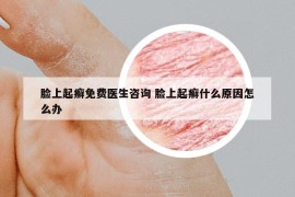 脸上起癣免费医生咨询 脸上起癣什么原因怎么办