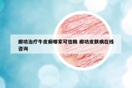 廊坊治疗牛皮癣哪家可信赖 廊坊皮肤病在线咨询