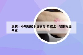 皮肤一小块粗糙干皮癣是 皮肤上一块的粗糙干皮