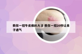 教你一招牛皮癣的方法 教你一招20秒让鼻子通气
