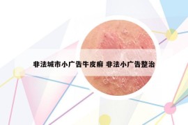 非法城市小广告牛皮癣 非法小广告整治