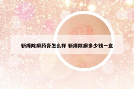 斩痒除癣药膏怎么样 斩痒除癣多少钱一盒