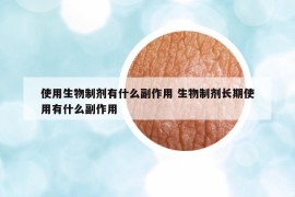 使用生物制剂有什么副作用 生物制剂长期使用有什么副作用