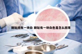 脚趾间有一块白 脚趾有一块白色是怎么回事