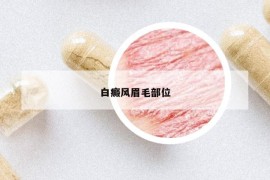 白癜风眉毛部位