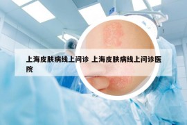上海皮肤病线上问诊 上海皮肤病线上问诊医院
