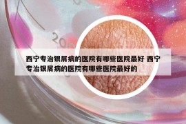 西宁专治银屑病的医院有哪些医院最好 西宁专治银屑病的医院有哪些医院最好的