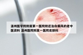 温州医学院附属第一医院附近治白癜风的老中医资料 温州医院附属一医院皮肤科