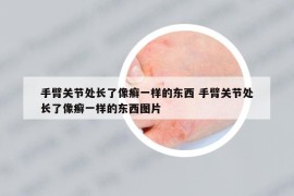 手臂关节处长了像癣一样的东西 手臂关节处长了像癣一样的东西图片