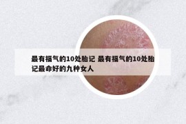 最有福气的10处胎记 最有福气的10处胎记最命好的九种女人