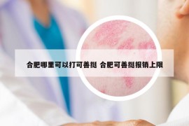 合肥哪里可以打可善挺 合肥可善挺报销上限