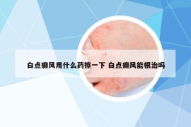 白点癫风用什么药擦一下 白点癫风能根治吗